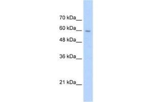 Western Blotting (WB) image for anti-Solute Carrier Family 22 (Organic Cation Transporter), Member 1 (SLC22A1) antibody (ABIN2462426) (SLC22A1 anticorps)