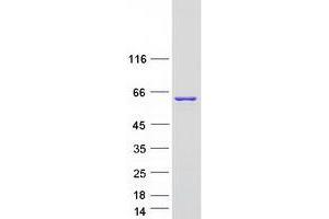 Validation with Western Blot