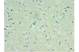 Immunohistochemistry of paraffin-embedded human brain tissue using ABIN7170477 at dilution of 1:100 (SPAG16 anticorps  (AA 1-183))