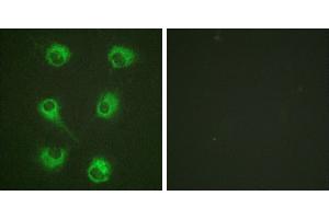 Peptide - +Immunofluorescence analysis of HuvEc cells, using CrkL (Ab-207) antibody (#B0067). (CrkL anticorps  (Tyr207))