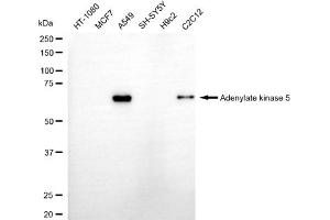 Western blotting analysis using adenylate kinase 5 antibody (ABIN7797523).