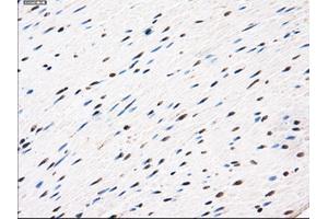 Immunohistochemical staining of paraffin-embedded Ovary tissue using anti-AKR1A1mouse monoclonal antibody. (AKR1A1 anticorps)