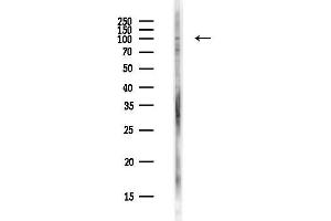 Western blot analysis of lysates from PC12 cells(heat-shock,45 min treatment), using ZNF574 Antibody at 1/1000 dilution.