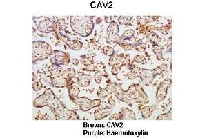 Sample Type :  Human placental tissue   Primary Antibody Dilution :   1:50  Secondary Antibody :  Goat anti rabbit-HRP   Secondary Antibody Dilution :   1:10,000  Color/Signal Descriptions :  Brown: CAV2 Purple: Haemotoxylin  Gene Name :  CAV2  Submitted by :  Dr. (Caveolin 2 anticorps  (N-Term))