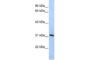 WB Suggested Anti-SYNGR4 Antibody Titration:  0. (SYNGR4 anticorps  (N-Term))