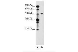Image no. 2 for anti-Solute Carrier Family 39 (Zinc Transporter), Member 6 (SLC39A6) (AA 26-75) antibody (ABIN205014) (SLC39A6 anticorps  (AA 26-75))
