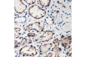 Immunohistochemical analysis of DMGDH staining in human kidney formalin fixed paraffin embedded tissue section.