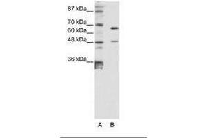 Image no. 1 for anti-Zinc Finger Protein 597 (ZNF597) (AA 48-97) antibody (ABIN6736181) (ZNF597 anticorps  (AA 48-97))