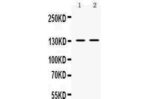 Western blot analysis of TRPM5 expression in SMMC whole cell lysates (lane 1) and 293T whole cell lysates (lane 2). (TRPM5 anticorps  (AA 1021-1108))