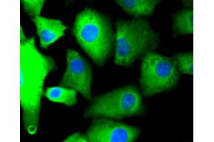 Immunofluorescence analysis of A549 cells using PRKCA antibody (ABIN4904772). (PKC alpha anticorps)