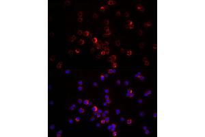 Immunofluorescence analysis of THP-1 cells using CXCL12 antibody (ABIN6130152, ABIN6139271, ABIN6139272 and ABIN6217180) at dilution of 1:200. (CXCL12 anticorps  (AA 22-89))