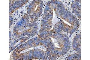 IHC analysis of TRAM1L1 using anti-TRAM1L1 antibody (ABIN7602939). (TRAM1L1 anticorps  (C-Term))