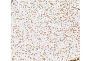 Immunohistochemistry (IHC) image for anti-Dpy-30 Homolog (DPY30) (AA 1-50) antibody (ABIN7453464)
