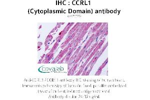 Image no. 2 for anti-Chemokine (C-C Motif) Receptor-Like 1 (CCRL1) (2nd Cytoplasmic Domain) antibody (ABIN1732791) (CCRL1 anticorps  (2nd Cytoplasmic Domain))