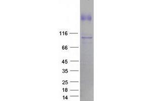 Validation with Western Blot