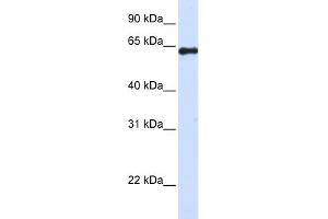 WB Suggested Anti-FAM116A Antibody Titration: 0. (FAM116A anticorps  (Middle Region))