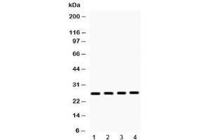 Western blot testing of 1) rat brain, 2) mouse ovary, 3) human 22RV1 and 4) human HeLa lysate with HMGB1 antibody at 0.