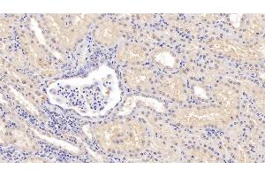 Detection of COMT in Human Kidney Tissue using Polyclonal Antibody to Catechol-O-Methyltransferase (COMT)