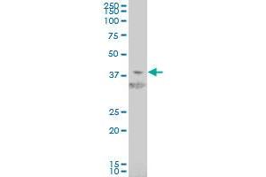 HIF1AN monoclonal antibody (M01), clone 1D8 Western Blot analysis of HIF1AN expression in Jurkat .