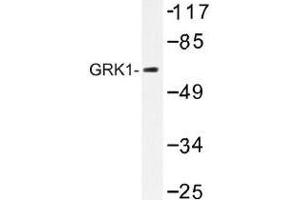 Image no. 1 for anti-G Protein-Coupled Receptor Kinase 1 (GRK1) antibody (ABIN317886) (GRK1 anticorps)