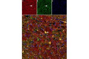 ω-Agatoxin IVA toxin co-localizes with presynaptic Anti-Neuroligin 1 (NLGN1) in mouse Cerebellum.