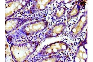 Immunohistochemistry of paraffin-embedded human small intestine tissue using ABIN7153569 at dilution of 1:100 (TUBGCP4 anticorps  (AA 203-309))