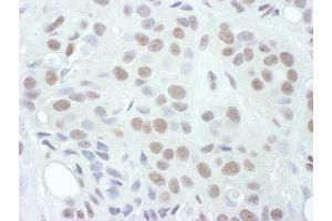 Immunohistochemistry (IHC) image for anti-Mitogen-Activated Protein Kinase Kinase 1 (MAP2K1) (pThr286) antibody (ABIN7453460)