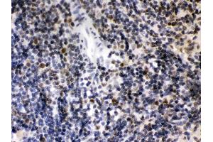 CIITA was detected in paraffin-embedded sections of rat spleen tissues using rabbit anti- CIITA Antigen Affinity purified polyclonal antibody (Catalog # ) at 1 µg/mL.