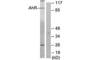 Western blot analysis of extracts from 293 cells, using AhR (Ab-36) Antibody. (Aryl Hydrocarbon Receptor anticorps  (AA 2-51))