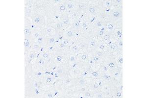 Immunohistochemistry of paraffin-embedded Human liver (negative control sample) using [KO Validated] p53 Rabbit mAb (ABIN7271080) at dilution of 1:100 (40x lens).