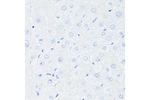 Immunohistochemistry of paraffin-embedded Human liver (negative control sample) using [KO Validated] p53 Rabbit mAb (ABIN7271080) at dilution of 1:100 (40x lens). (p53 anticorps)