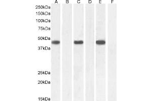 (ABIN185040) (2 μg/mL) staining of A549 (A) + peptide (B), K562 (C) + peptide (D), HeLa (E) + peptide (F) cell lysate (35 μg protein in RIPA buffer).