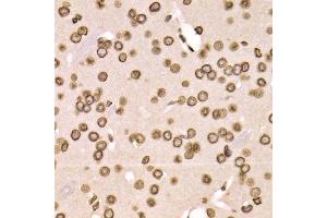 Immunohistochemistry of paraffin-embedded mouse brain using LMNB2 Antibody.