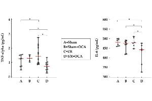 OCA treatment decreases cortex TNF-alpha and IL-6 in rats submitted to partial liver ischemia (60 min) followed by reperfusion (120 min). (IL-6 Kit ELISA)
