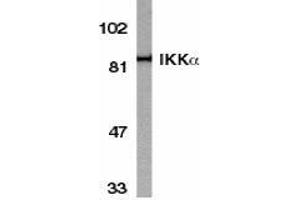 Western blot analysis of IKK alpha in HeLa whole cell lysate with AP30403PU-N IKK alpha antibody at 1/1000 dilution. (IKK alpha anticorps  (C-Term))