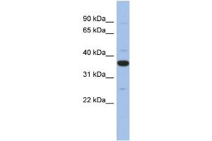 WB Suggested Anti-MYD88 Antibody Titration: 0. (MYD88 anticorps  (Middle Region))