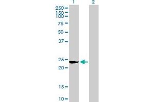 Western Blot analysis of GSTM3 expression in transfected 293T cell line by GSTM3 MaxPab polyclonal antibody. (GSTM3 anticorps  (AA 1-225))