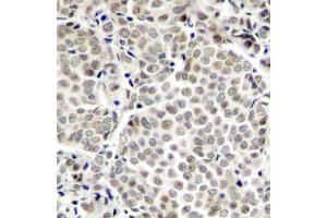 Immunohistochemistry (IHC) image for anti-Nuclear Factor-kB p65 (NFkBP65) (pSer529) antibody (ABIN1870581) (NF-kB p65 anticorps  (pSer529))