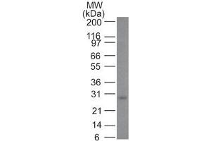 Western Blot Analysis of Bcl-2 in human skin Bcl-2 Mouse Monoclonal Antibody (100/D5).