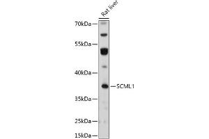 Western blot analysis of extracts of Rat liver, using SCML1 antibody (ABIN7270268) at 1:1000 dilution. (SCML1 anticorps  (AA 50-200))