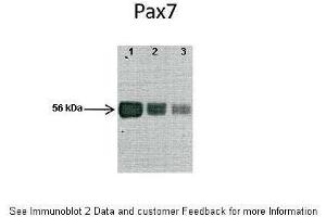 Lanes:   1: Mouse skeletal muscle lysate, 2: Mouse skeletal muscle lysate, 3: Mouse skeletal muscle lysate  Primary Antibody Dilution:   1:1000  Secondary Antibody:   Anti-rabbit HRP  Secondary Antibody Dilution:   1:10000  Gene Name:   PAX7  Submitted by:   Anonymous