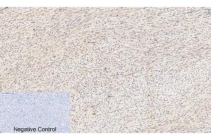 Immunohistochemical analysis of paraffin-embedded human uterus tissue.
