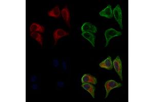 ABIN6261296 and ABIN6277276 staining HepG2 cells by IF/ICC.
