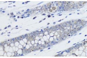 Immunohistochemistry of paraffin-embedded Human colon using MonoMethyl-Histone H4-K20 Polyclonal Antibody at dilution of 1:200 (40x lens).