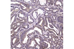 IHC analysis of HTRA1 using anti-HTRA1 antibody . (HTRA1 anticorps)