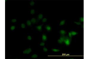 Immunofluorescence of monoclonal antibody to DPH1 on HeLa cell. (DPH1 anticorps  (AA 216-324))