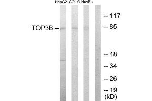 Western Blotting (WB) image for anti-Topoisomerase (DNA) III beta (TOP3B) (N-Term) antibody (ABIN1849086) (TOP3B anticorps  (N-Term))