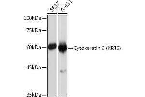 Western blot analysis of extracts of various cell lines, using Cytokeratin 6 (KRT6) (KRT6) Rabbit mAb (ABIN7268104) at 1:1000 dilution. (Keratin 6C anticorps)