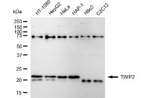 Western blotting analysis using TIMP2 antibody (ABIN7799376).