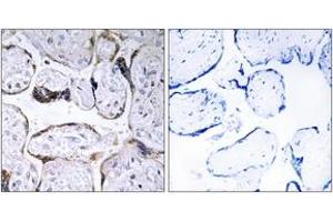 Immunohistochemistry analysis of paraffin-embedded human placenta, using ELOVL3 Antibody. (ELOVL3 anticorps  (AA 31-80))